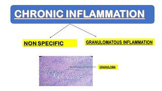 Chronic Inflammation  A Complete Update [upl. by Webb]