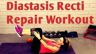 15 Minute Diastasis Recti Repair WorkoutPostnatal Core After Pregnancy [upl. by Adonis]