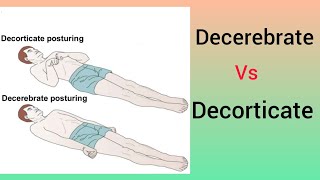 Nursing officers Decerebrate vs Decorticate [upl. by Maighdiln187]