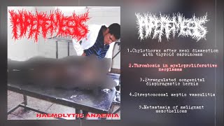 Hyperemesis  Haemolytic Anaemia Split with PxCxSx 2013 Goregrind [upl. by Yatnuahc287]