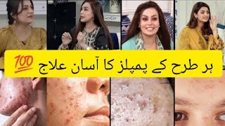 quotProven Tips to Get Rid of Pimples amp Scars Fast  Skincare Secrets by Sadia Imam amp Hibaquot [upl. by Marpet268]