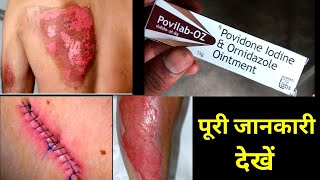 Povilab OZ Ointment Uses Or Side Effects in hindi [upl. by Dannica]