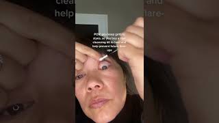 The best stye system styes eyeproblem eyecaretips [upl. by Adnocahs]