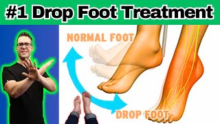 10 BEST Foot Drop Treatments amp Exercises Braces Shoes Orthotics [upl. by Yolanda]