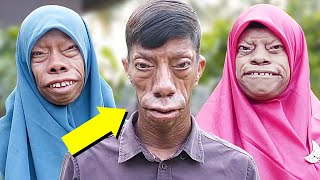 Meet The Family Whose Faces Change Shape What Are They Hiding [upl. by Daryle]