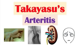 Takayasu’s Arteritis Pulseless Disease  Large Vessel Vasculitis Symptoms Diagnosis Treatment [upl. by Lagas]