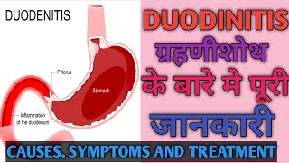 Duodinitis Details Causes Symptoms and treatment ग्रहणीशोथ। Explained in detail [upl. by Cochran]