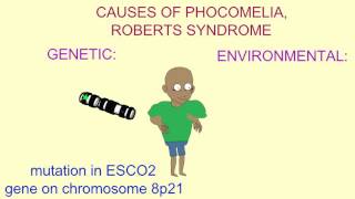 GENETIC amp ENVIRONMENTAL CAUSES OF PHOCOMELIA [upl. by Airdnna]