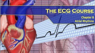 The ECG Course  Atrial Rhythms [upl. by Valentino]