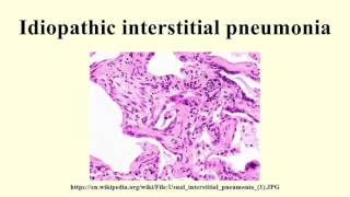 Idiopathic interstitial pneumonia [upl. by Siloam]