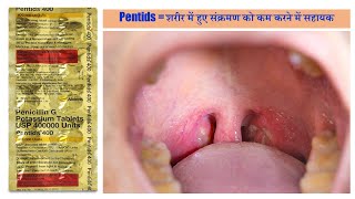 Pentids 400 Tablet Penicillin G or Benzylpenicillin बैक्टीरिया के सेल वाल को ख़तम करने वाली दवा [upl. by Verena]