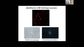 Toshihiko Momiyama  Receptor modulation of excitatory transmission to cholinergic neurons in rats [upl. by Minta]