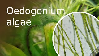 Oedogonium Algae Under a Microscope 100x1000x [upl. by Naillil340]