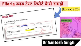 How To Read Filaria Blood Test Report Dr Santosh Singh Episode 25 [upl. by Ahsiatal]