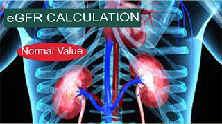 eGFR Calculation [upl. by Rednirah]