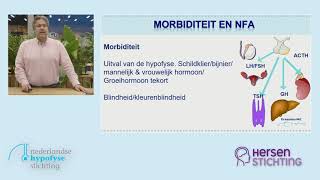 Webinar multimorbiditeit  fragment dr Sebastian Neggers [upl. by Greeson983]