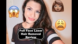 FULL FACE LASER HAIR REMOVAL  My Experience  Tips etc [upl. by Pussej]