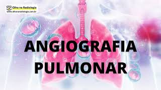 ANGIOGRAFIA PULMONAR [upl. by Cogswell]