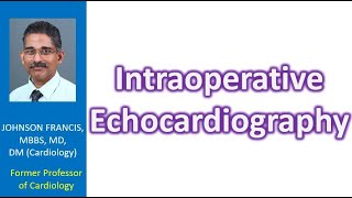 Intraoperative Echocardiography [upl. by Faxen]