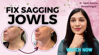 Sagging Jowls Dermatologists Secrets for a Tight Jawline Without Surgery [upl. by Oswald841]