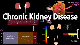 Chronic Kidney Disease Animation [upl. by Ailhad]