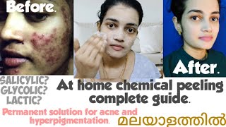 Chemical peeling in Malayalam Acid peeling Salicylic peel Glycolic peel Lactic peel TCA peel [upl. by Wilsey]