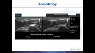 Terasons Introduction to MSK Ultrasound Guided Procedures with Dr Gruba Part 1 [upl. by Anya]