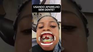 APARELHO SEM DENTE [upl. by Ahsemrac]