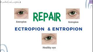 REPAIR ECTROPION amp ENTROPION CPT TOPICS MEDICAL CODING AND BILLING medicalcodercertified [upl. by Justis]