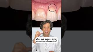 ⚠️¿RECESIÓN de ENCÍAS La causa es un CEPILLADO DENTAL AGRESIVO 🦷 shorts [upl. by Illil]