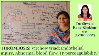 THROMBOSIS Virchow triad Endothelial injury Abnormal blood flow Hypercoagulability [upl. by Walcoff]