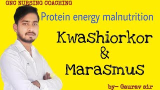 Protein energy malnutrition kwashiorkor and marasmus [upl. by Nwonknu]