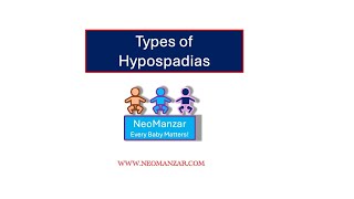 Hypospadias Types Newborn Infants [upl. by Helyn450]