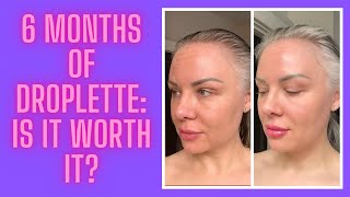 6 Month Update of Droplette Is it worth the investment [upl. by Consuelo]