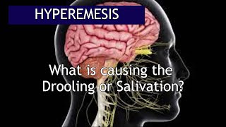 Hyperemesis What causes the Excessive Salivation  Antai Hospital [upl. by Atteuqcaj]