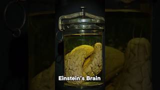 Whats wrong with Einstein brain einstein brain [upl. by Ramor86]