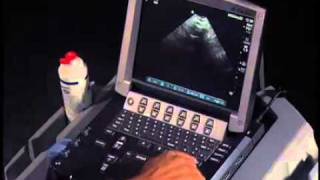 How To Transabdominal View of the Female Pelvis with Ultrasound [upl. by Fronniah]