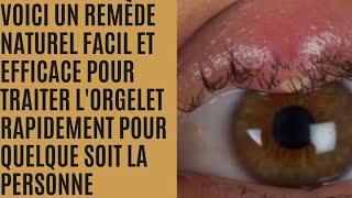 comment traiter un orgelet rapidement et naturellement [upl. by Ariana485]