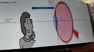 Engineering This a complete review of how a Retinoscope amp CameraEyes Optics works Interactively [upl. by Noiraa]