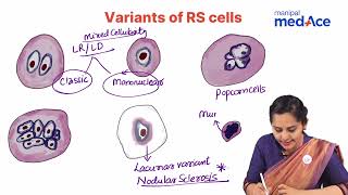 Hodgkin Lymphoma Pathology Explained  Dr Ranjana Ranade  Manipal MedAce Exam Prep [upl. by Ellery291]