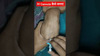 IV Cannula Kaise Lagaye short cannula 22 no 207 [upl. by Elsey]