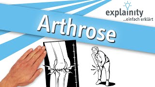 Arthrose einfach erklärt explainity® Erklärvideo [upl. by Aital280]