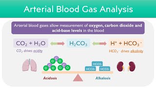 Arterial Blood Gas ABG Interpretation  Worked Examples [upl. by Eislek501]