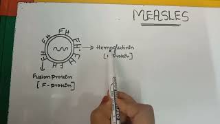 Measlescausesroute of spreaddiagnosepreventioncomplicationsTreatment [upl. by Annaej]