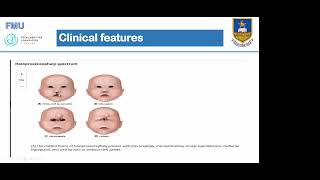 FMU CasesAlobar holoprosencephaly and Advanced Tubal Pregnancy by Dr T Murinye [upl. by Akemahs506]