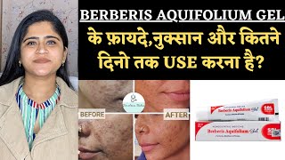 Berberis Aquifolium Gel Benefits amp Side effects ॥ कितने दिन में Results मिलते है [upl. by Meta]