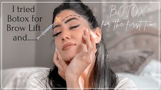 Botox Brow Lift Injection Patterns Botox MarkUp Tutorial [upl. by Polik]