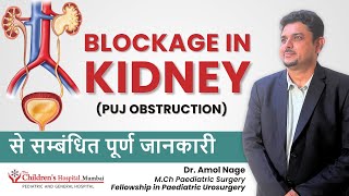 PUJ Obstruction in Infants  Pyeloplasty surgery for Kidney by Dr Amol Nage [upl. by Erait]