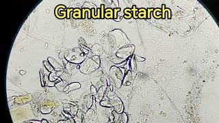 Granular starch in Stool sample stooltest stoolanalysis stoolexamination فحص الخروج [upl. by Svensen136]