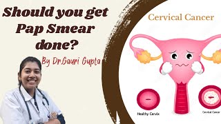 Should you get Pap Smear done [upl. by Ellennaj735]